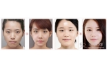 雅美翘睫美瞳，眼部整形全方位特惠