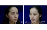 雅美‘花样美人’抗敏感肌肤夏季大优惠